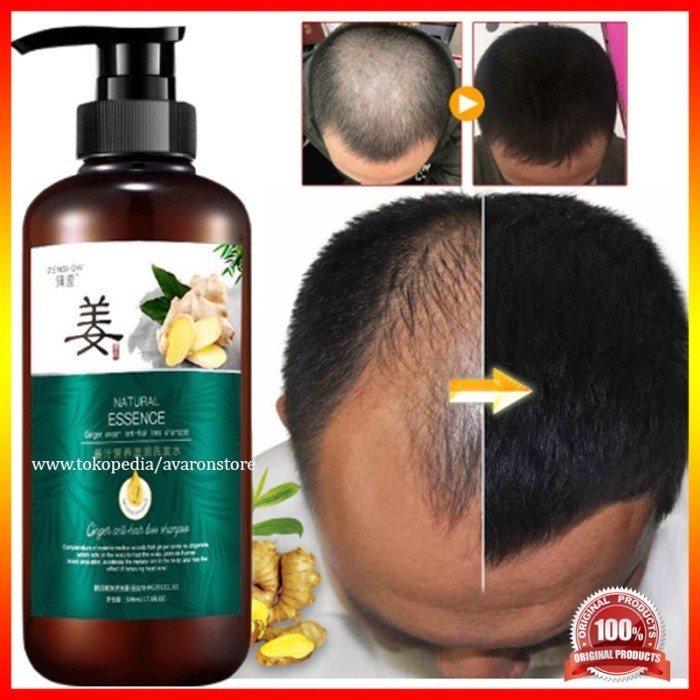 Shampoo Penumbuh Rambut Zhenxiu Ginger Juice 500ml
