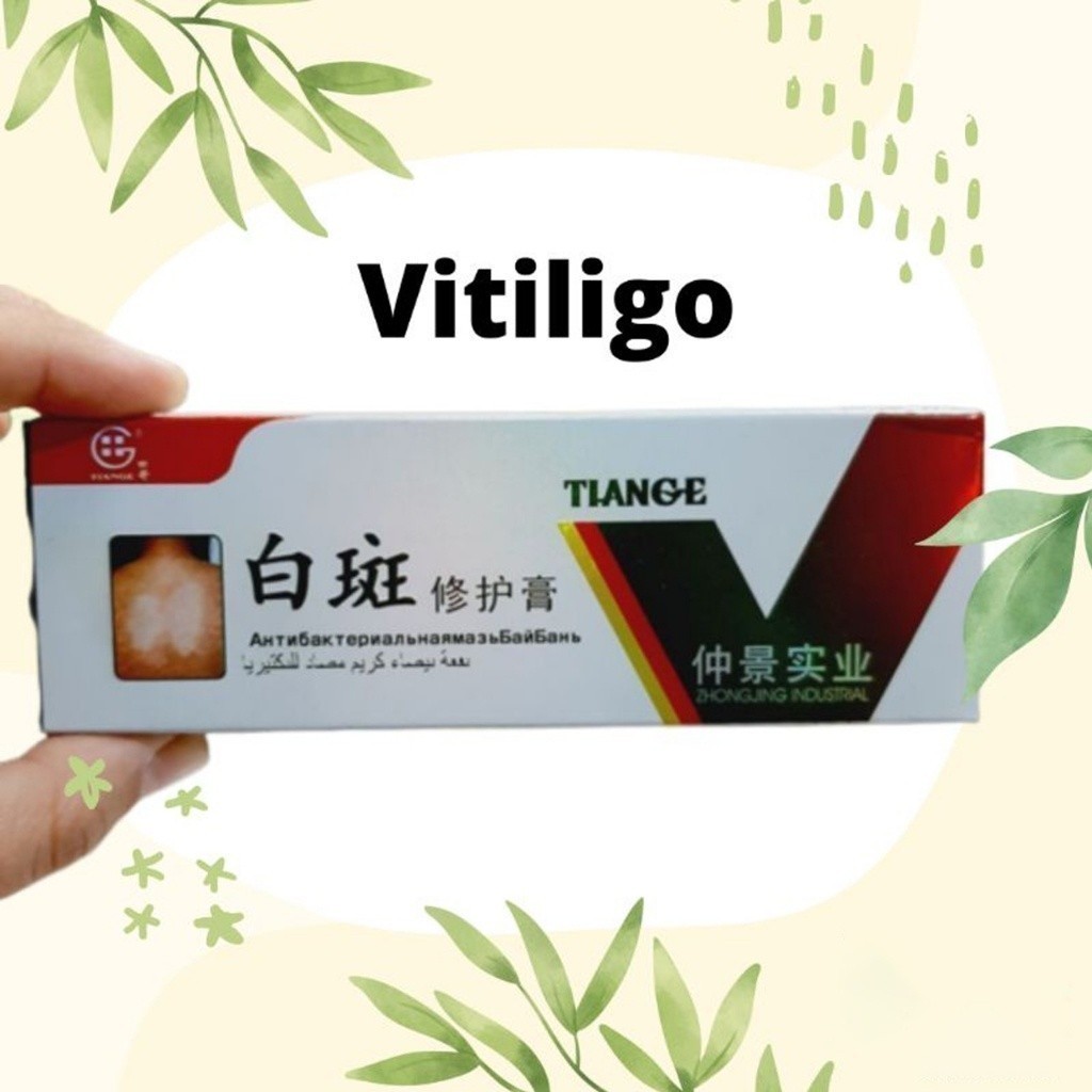 TIANGE Obat Salep Herbal China Tiange Untuk Vitiligo Penghilang Bercak Putih Bintik Putih Cuan Laris