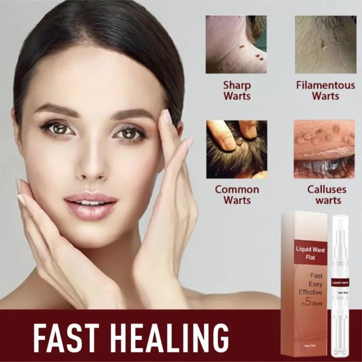 Penghilang kutil Penghilang tahi lalat di wajah Penghilang kutil dan tahi lalat Penghilang tahi lala