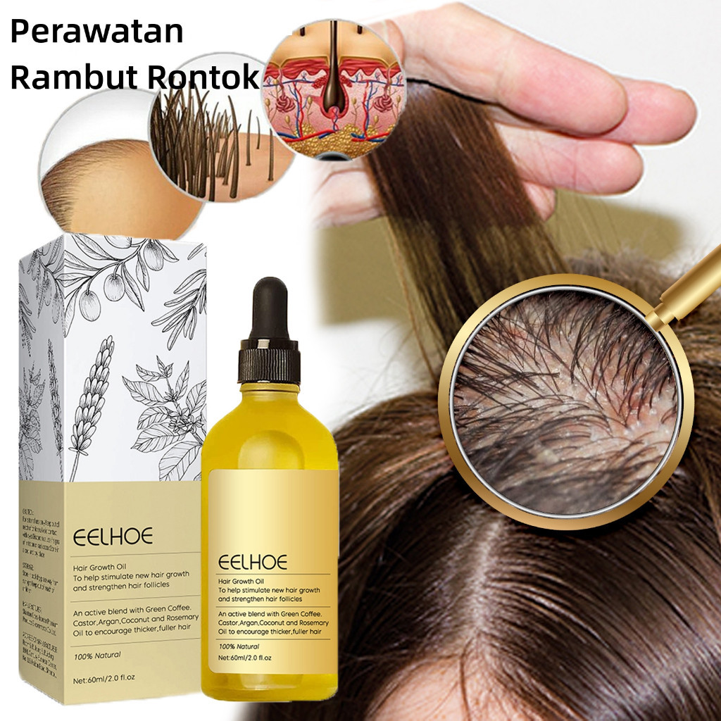 RB EELHOE Rosemary Oil Rambut Penumbuh Rambut Botak Perawatan Rambut Rontok Penumbuh Rambut Cepat