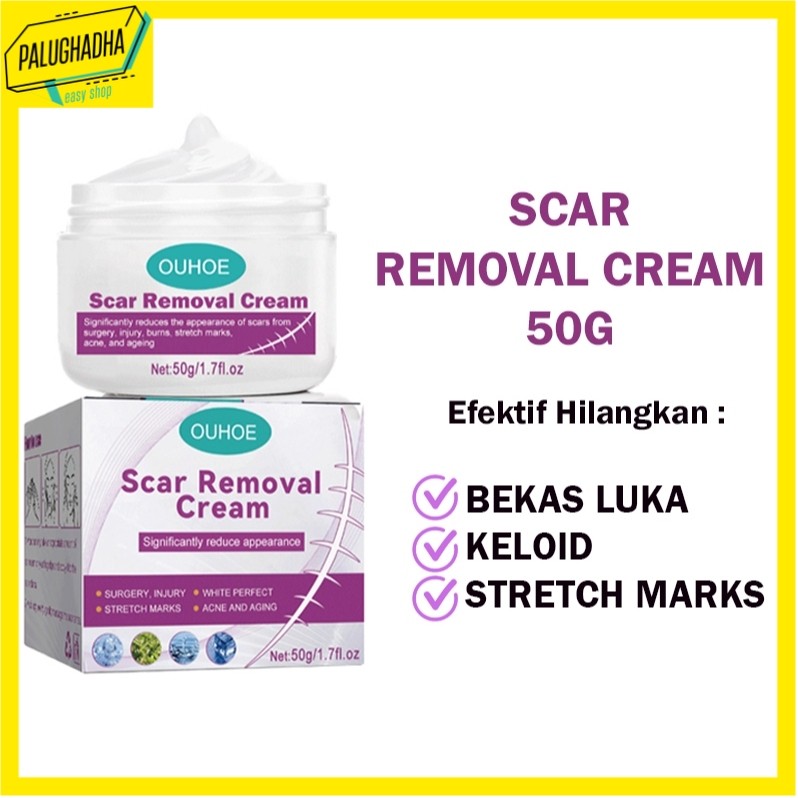 [50g] OUHOE Scar Remover Cream Penghilang Bekas Luka/Koreng/Penghilang Strechmark Ampuh - PALUGHADHA