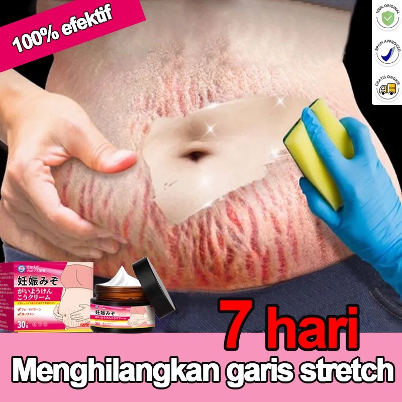 【BPOM】Krim Penghilang Stretch Mark Penghilang Stretch Mark Paling Ampuh Penghilang Stretch Mark 30g 