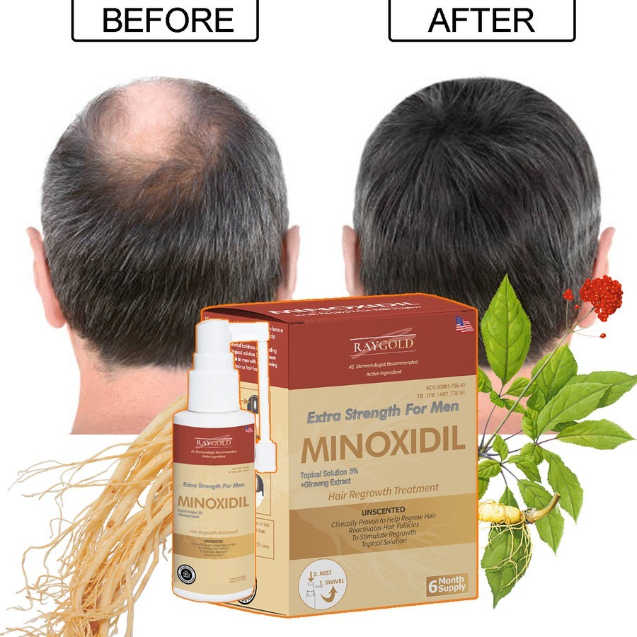 MINOXIDIL5%penumbuh rambut & brewok with Ginseng extract for MEN made in USA - RAYGOLD -  MINOX MINO