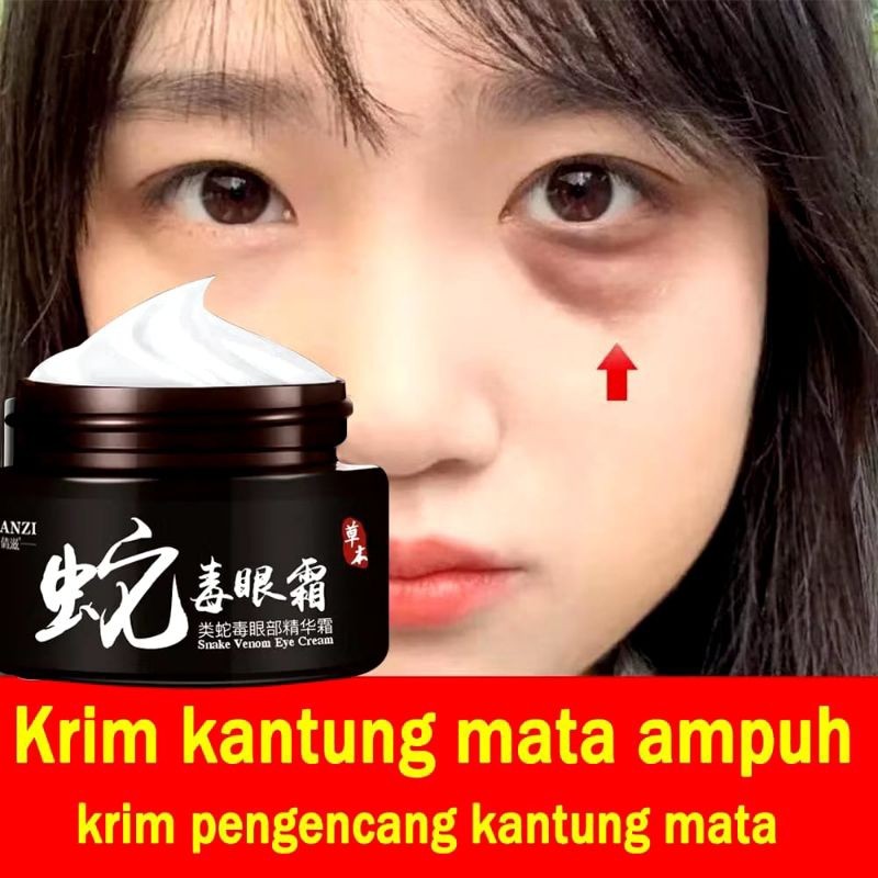 JJ Cream Mata Qianzi Penghilang Kerutan Mata Panda