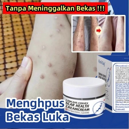 Penghilang bekas luka hitam koreng Penghilang bekas luka di kaki Penghilang Bekas cacar Bekas gigita