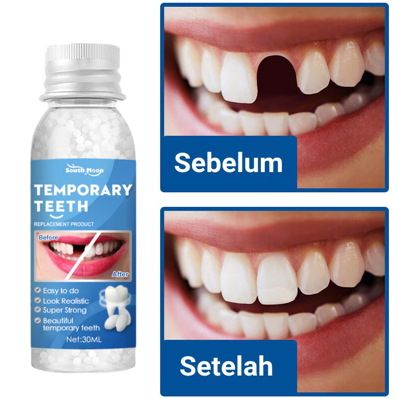 penambal gigi berlubang gigi palsu dokter permanen tambal gigi permanen 30ML lem gigi palsu permanen