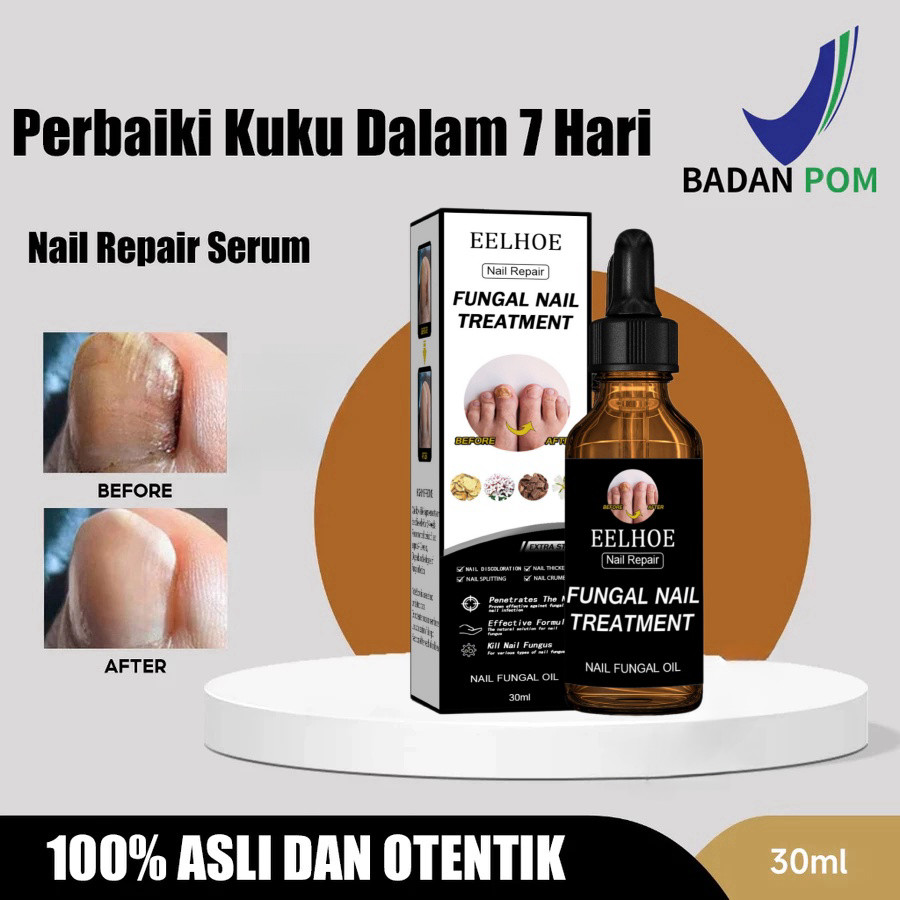 Obat Jamur Kuku Obat kuku jamur dan rusak Nail Repair Essence Serum Memperbaiki Kuku Rusak Penghilan
