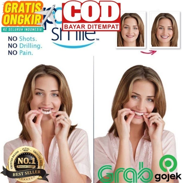 SET VENEER PELAPIS GIGI OMPONG - SEPASANG ATAS DAN BAWAH