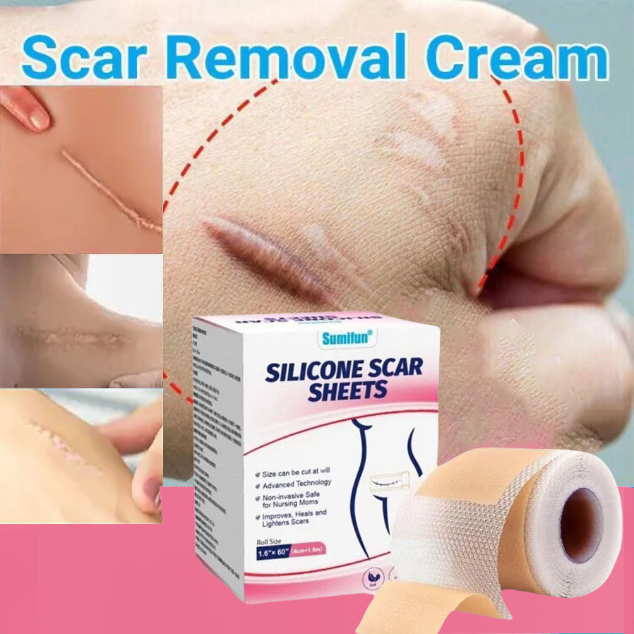 Silicone Scar Sheet Gel / Silikon Penghilang Keloid Bekas Luka / Gigitan Nyamuk Bekas Luka Di Kaki K