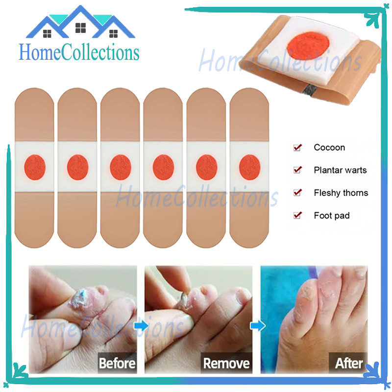6 Pcs Plester Mata Ikan/Plester Obat Kutil & Mata Ikan Case/ Plester Kutil Mata Ikan Penghilang Kuti