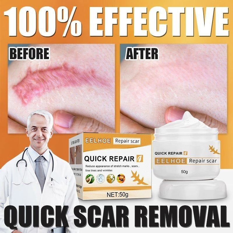 【COD ORI】EELHOE Cream Penghilang Bekas Luka Hitam/Menghilangkan Jerawat Dan Stretch Marks/Bekas Lama