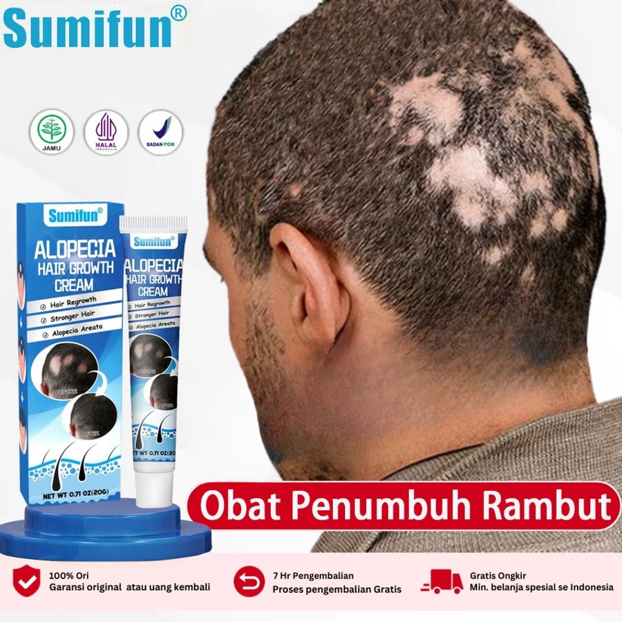 Sunmifun Obat Alopecia Areata, Obat Penumbuh Rambut Botak, Obat Botak Koin, Obat Banyak Pitak, Obat 