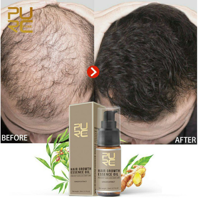 Vitamin Rambut Purc Penumbuh Rambut Original Pria Wanita