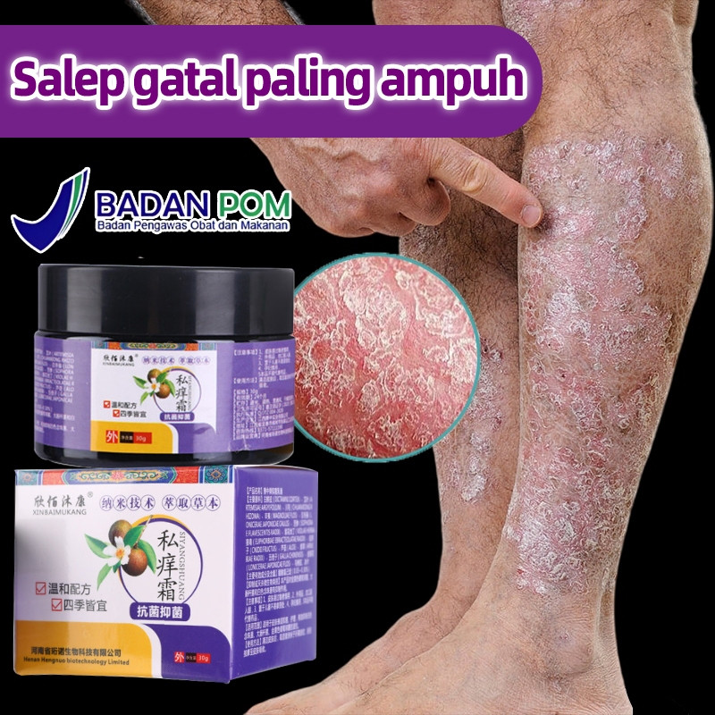 salep gatal paling ampuh 30gr salep gatal obat gatal selangkangan obat selangkangan gatal dan hitam 