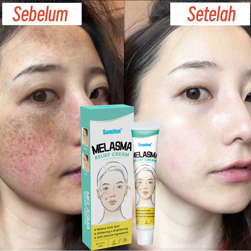Flek Hitam Krim Bintik Pemutih Niacinamide 20G Penghilang Flek Hitam Membandel Mencerahkan Bintik-Bi