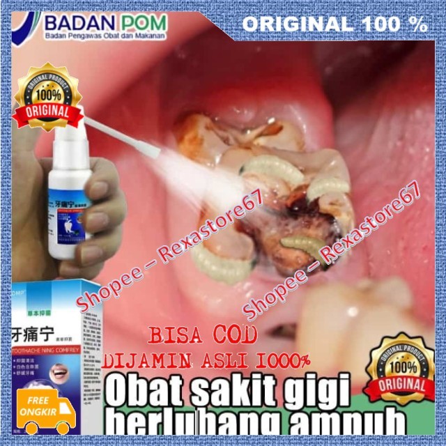 Spray Pereda Sakit Gigi Toothache Obat Sakit Gigi Berlubang Obat Sakit Gigi Semprot Ampuh ASLI