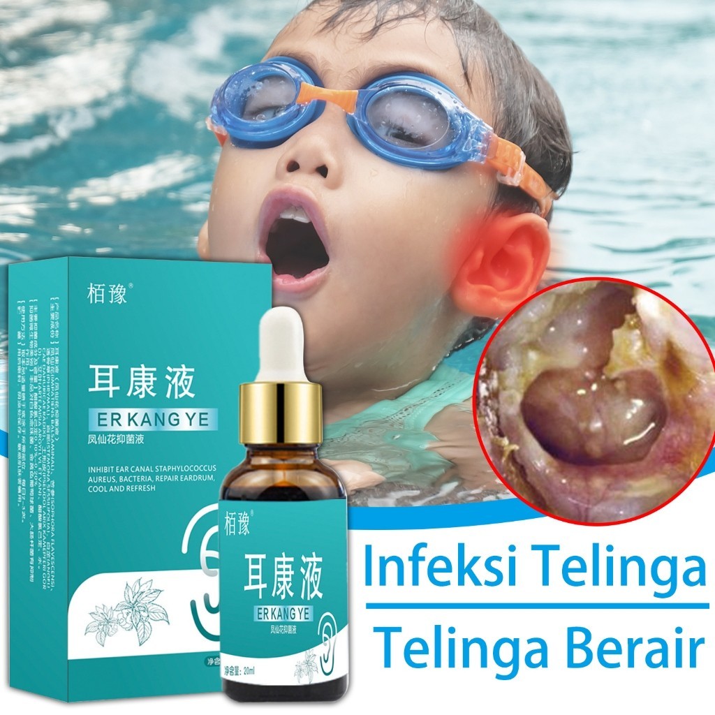 Obat Tetes Telinga ,Obat Tetes Kotoran Telinga, Penghancur Kotoran Telinga Keras Kering Menumpuk