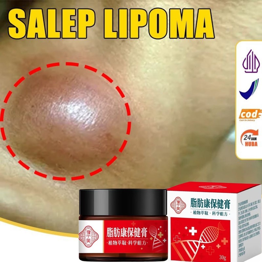 loli Obat Benjolan Lipoma Krim lipoma OBAT OLES PENGHILANG BENJOLAN LIPOMA 30g Obat Kista Ganglion,