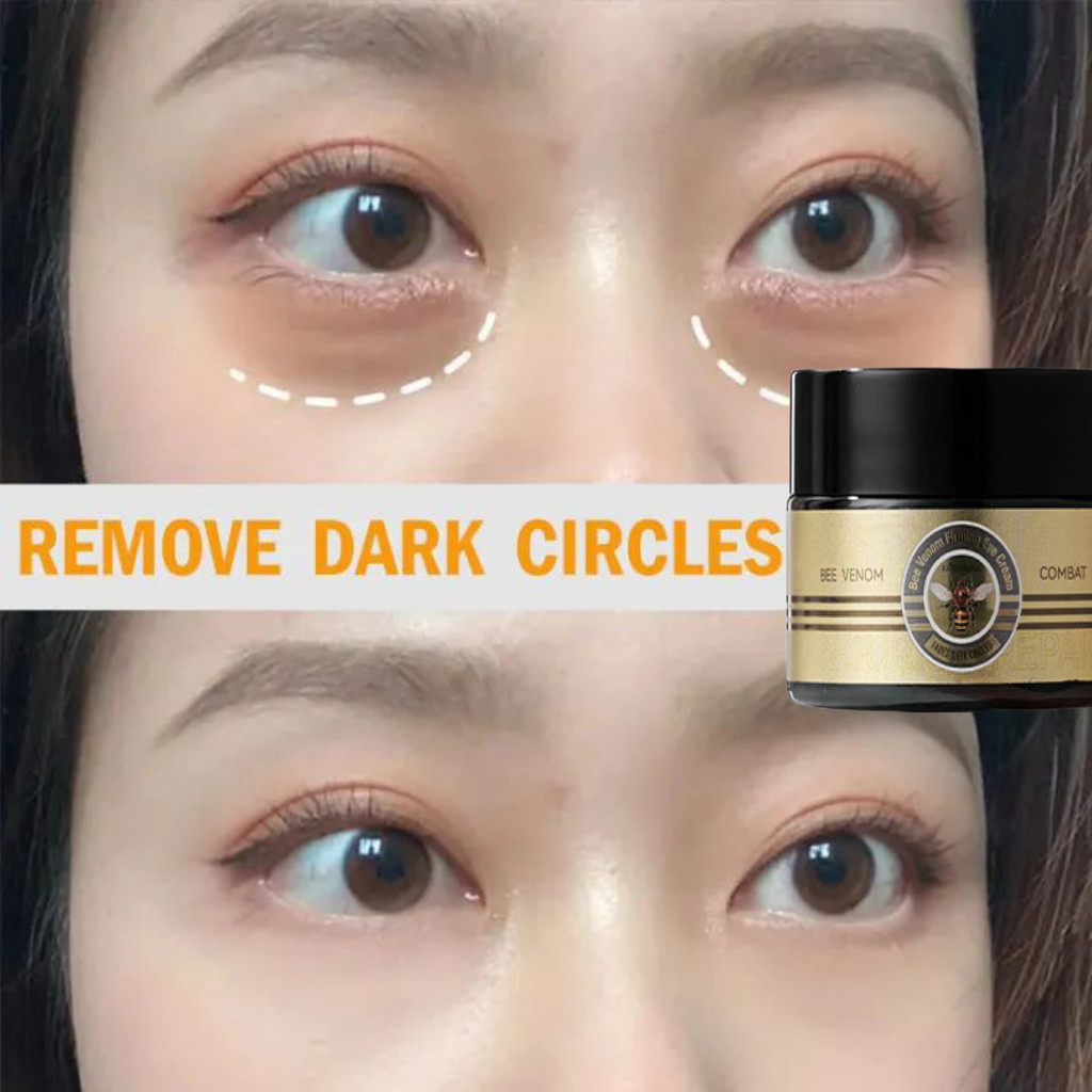 KORMESIC eye cream/menghilangkan mata panda/penghilang kantung mata/eye cream mata panda/serum mata 