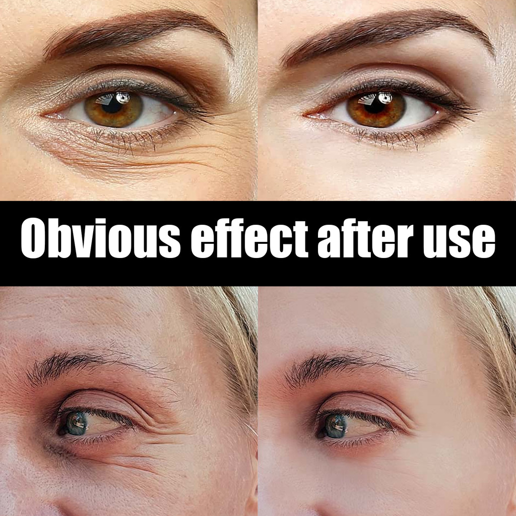 EELHOE Krim Mata Astaxanthin Caviar Melembapkan Perawatan Kulit Mengencangkan Kulit Mencerahkan Krim