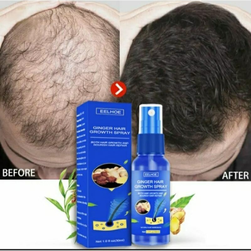 Serum penumbuh rambut Eelhoe Ginger Hair Growth Spray 30ml