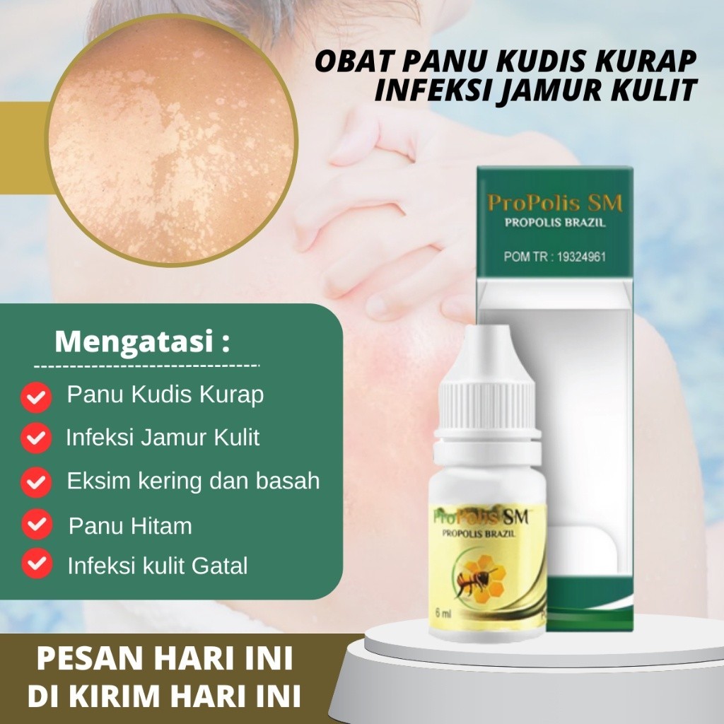 Salep Panu, Penghilang Jamur Kulit Panu , Obat tetes panu, Obat Jamur Kulit Anak, Obat Infeksi Jamur