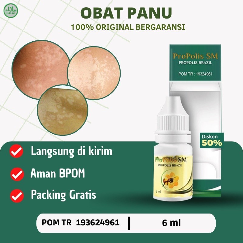 Propolis SM - Obat Panu , Obat Panu cair, Obat Panu anak, Obat Oles panu, Obat panu salep, Obat Gata