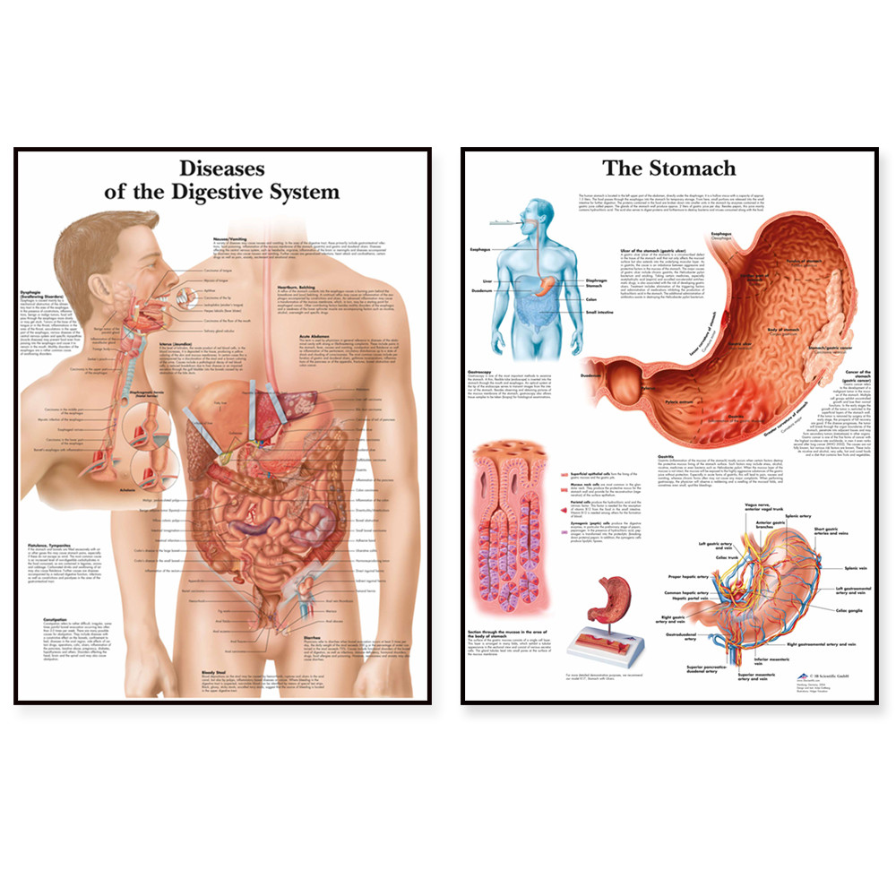 

Digestive System diagram Art Poster Print Body Map Canvas Painting Wall Pictures for Medical Education Home Decor