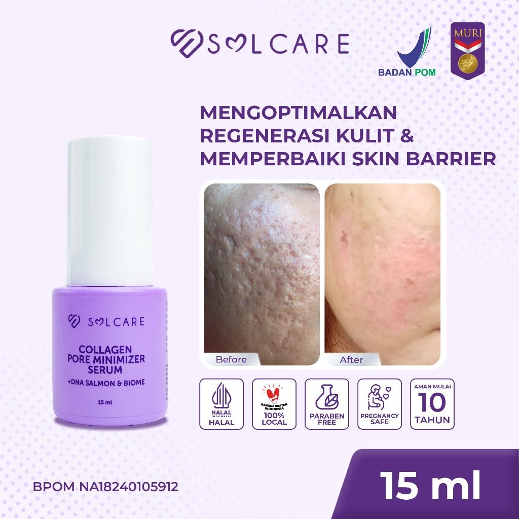 BELI 1 FREE 9 Solcare Collagen Pore Minimizer Serum + DNA Salmon & Biome – Serum Penghilang Bopeng &