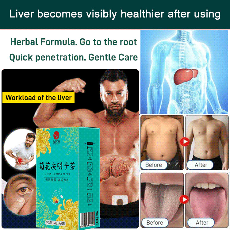 

100% Asli✅Nourishing Liver Heat Clearing Chrysanthemum Cassia Tea/Teh Penyembuh Api Dan Pelindung Hati Dari Biji Krisan Dan Cassia/Teh Kantong Yang Menjaga Kesehatan Teh Yang Menjaga Kesehatan Dan Melindungi Hati/Memelihara yin dan memberi nutrisi yang