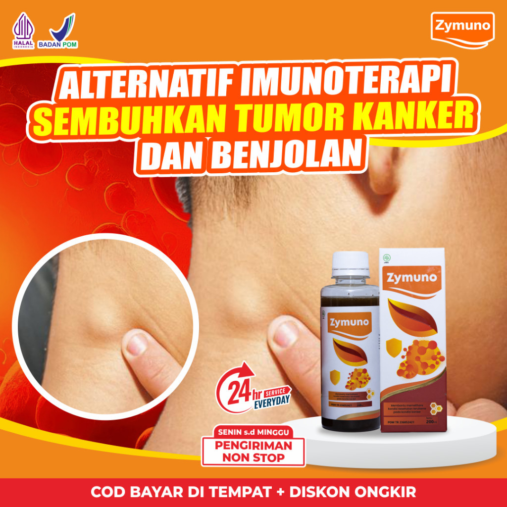 

Promo Obat Zymuno Madu Herbal Imunoterapi Alami untuk Pencegahan Kanker Tumor dan Peningkatan Daya Tahan Tubuh yang Optimal