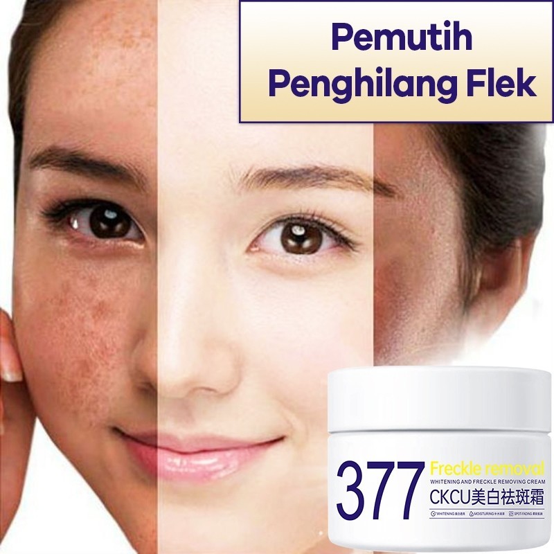 SymWhite 377 Cream Krim Penghilang Flek Hitam Krim Pemutih Penghilang Bintik Wajah Whitening Melasma