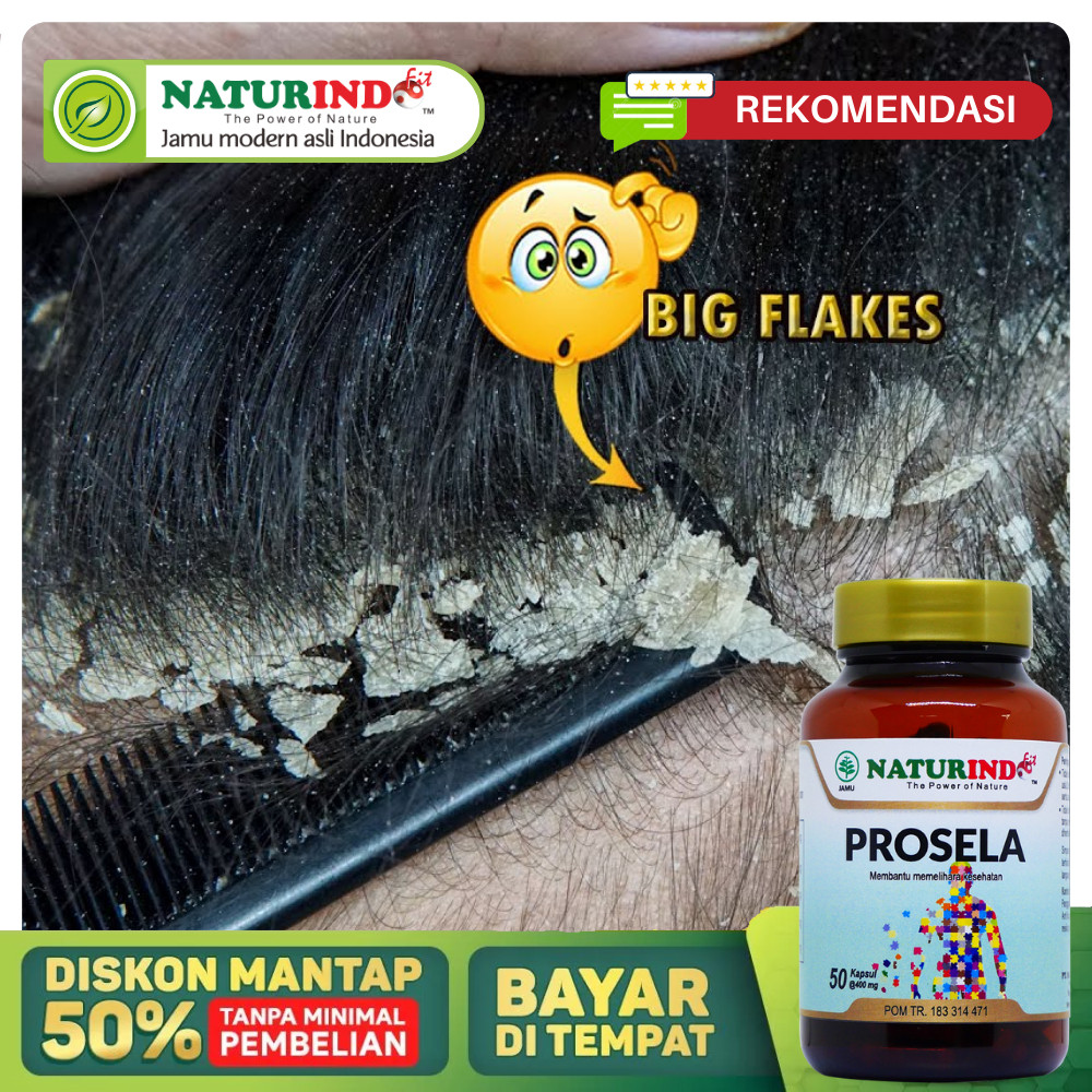 Obat ketombe Paling Ampuh Bpom, Ketombe Berkerak di Kepala, Herbal Penghilang Ketombe Parah, Kulit K