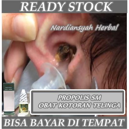 Obat Tetes Penghancur Kotoran Telinga Keras / Lunak, Obat Telinga