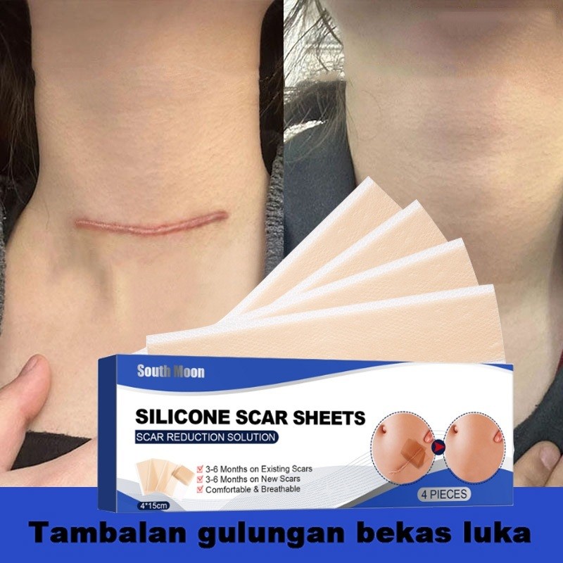 Silicone Scar Sheet Gel 4PCS 4cm x 7.5cm plester silikon penghilang keloid bekas luka Plester Bekas 