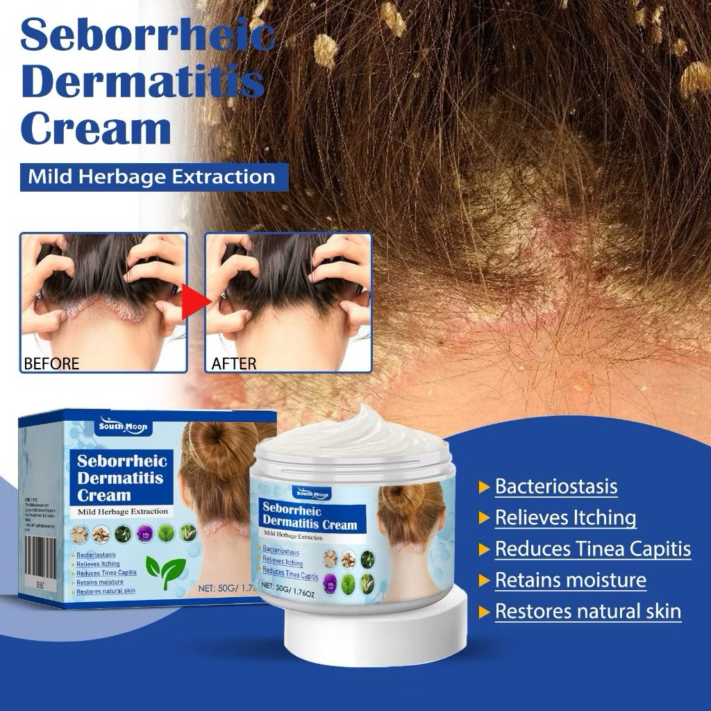 South Moon Seborrheic Dermatitis Cream 50g | Obat Dermatitis Seboroik, Psoriasis, Eksim & Ketombe di