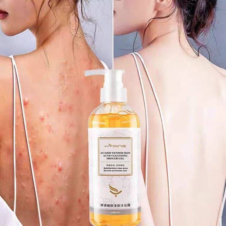 COD⚡Gel Mandi EksimSabun Kulit Anti Gatal Efektif Psoriasis Eksim Kering Tinea Gatal Punggung Sabun 