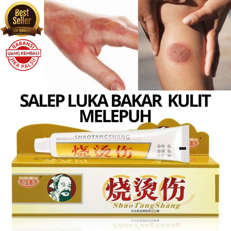 Salep Cina Herbal Huo Tuo Obat Luka Bakar Minyak Air Panas Knalpot Paling Ampuh