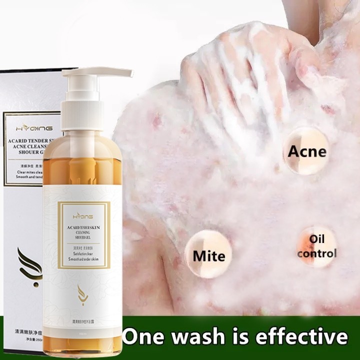Eczema body wash 260ml Obat gatal gatal kulit Pengobatan Eksim psoriasis eksim kering Kurap gatal ku