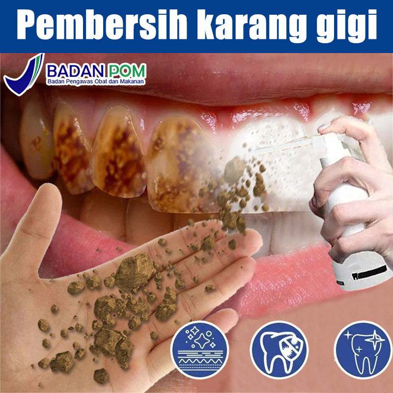 Perontok karang gigi paling ampuh Pembersih karang gigi Penghilang karang gigi 30ml Perontok karang 