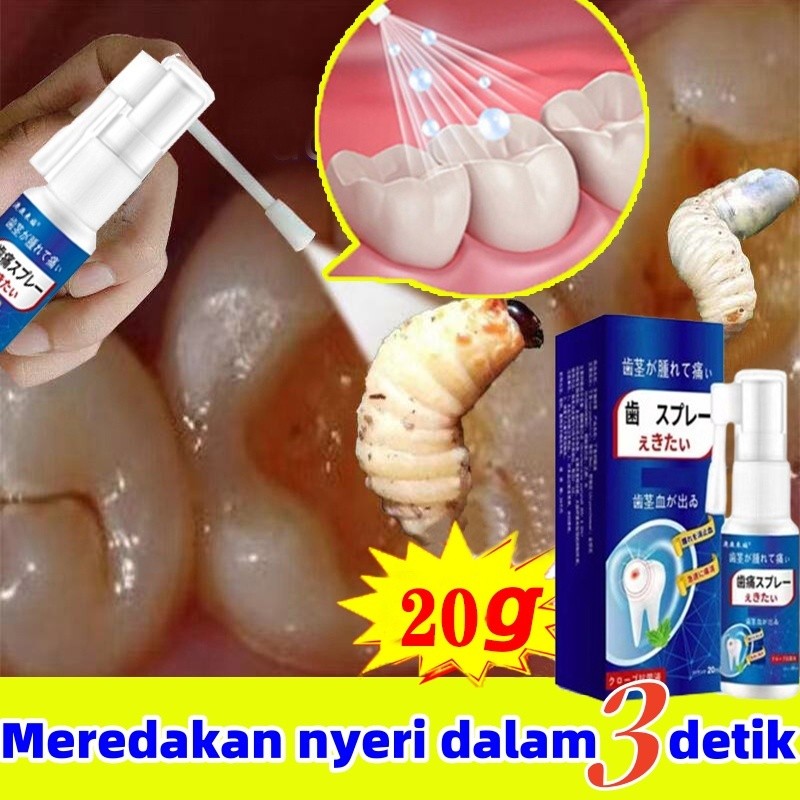 RB22 Obat sakit gigi Obat sakit gigi berlubang Obat sakit gigi semprot Obat sakit gigi ampuh Obat