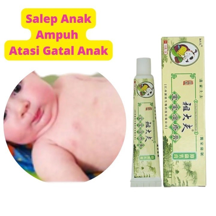 [TERMURAH] ZUDAIFU ANAK 15gr Original 100% - Salep Zu Dai Fu Khusus Anak Bayi Balita - Krim Cream Ob