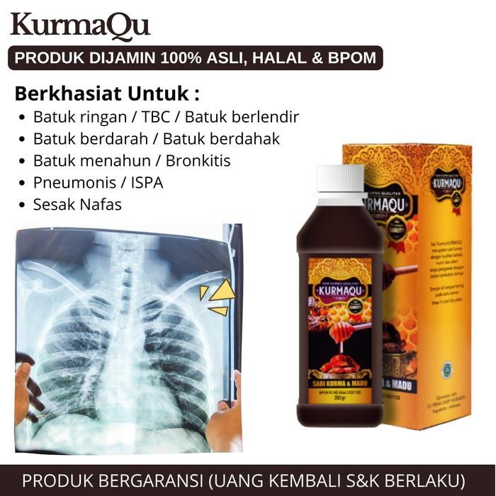 

Hot Produk KurmaQu Untuk Flek Paru, Bercak Di Paru Penyakit Tuberkulosis Atau Tbc Untuk Anak Dan Dewasa - KURMAQU Terbaik dan Terlaris