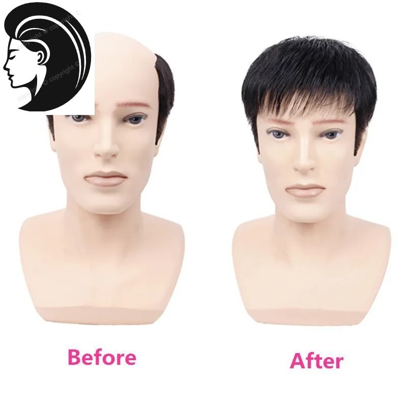 【Rambut nyata.】 Rambut Palsu Pria untuk Botak - Bisa Dicat & Rebonding, Natural -COD