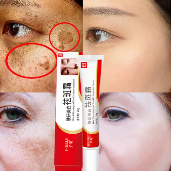HOUMAI Niacinamide Cream Pemutih Wajah Bintik Krim Bintik Niacinamide