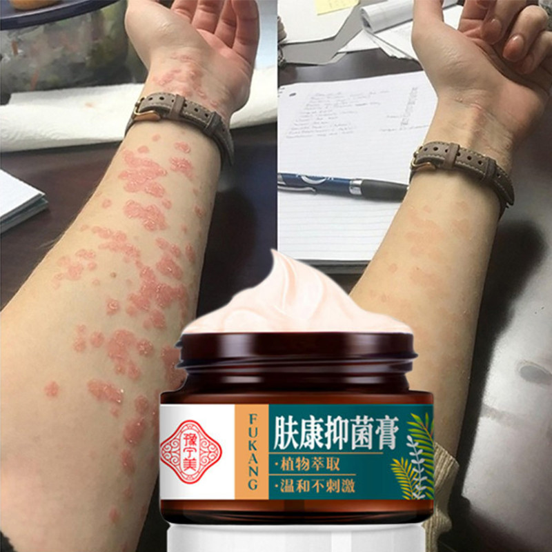 Salep gatal paling ampuh Obat Salep Kulit Jamur Dermatitis Psoriasis Eksim Jamur Kurap Alergi Kulit 