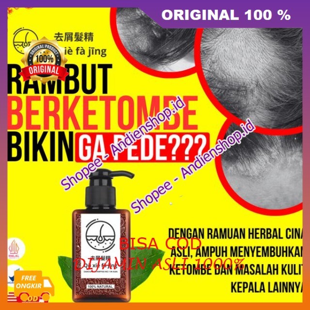 Qu Xi Fa Jing Shampoo Herbal Cina Atasi Ketombe, Rambut Rontok , Lepek, Bercabang Gatal Dan Jamur Am