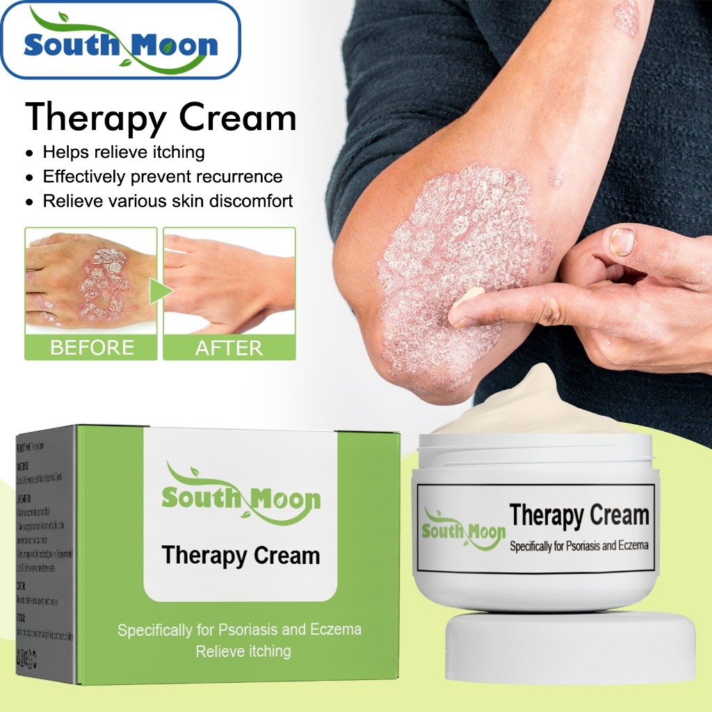 South Moon Psoriasis Antibacterial Cream 20g Skin Itching Relief Inhibit Fungus Urticaria Treatment