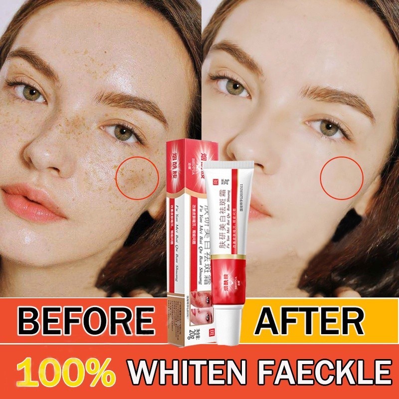 Krim Penghilang Bintik Hitam Penghilang Bintik Hitam Pelembab Anti-Penuaan Mencerahkan Glow Glow Kri