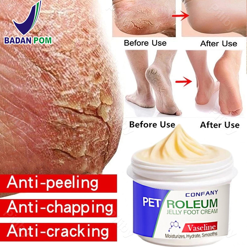 Obat kaki pecah Kaki Kering dan Pecah cream kaki pecah dan kering penghalus tumit kaki pecah Foot cr